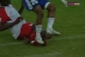Awful football accident- crushed/broken leg !!!